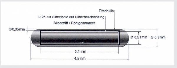 Seed Brachytherapie bei Prostatakrebs